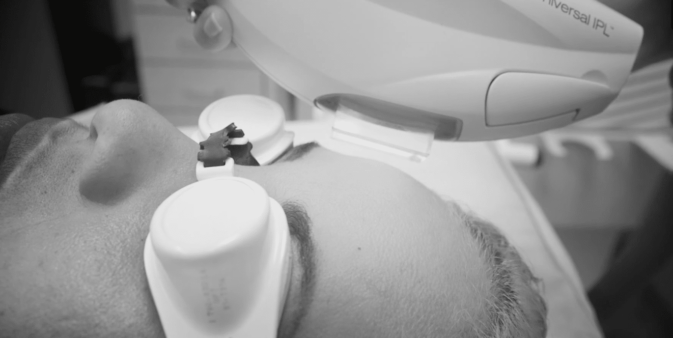 Screenshot 2026-05-22 at 24234 PM - Foundation Digital Media | Premier Video Production Services Patient undergoing anesthesia: close-up of face with a breathing mask connected to an anesthesia device above the head (grayscale).